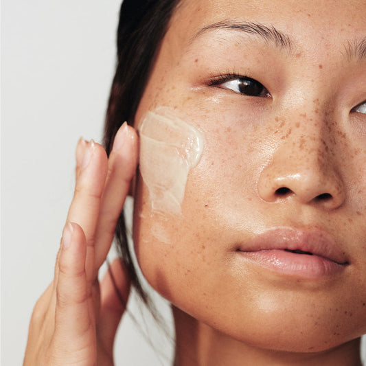 Hyperpigmentierung: Strahlende, makellose Haut - Ihr J- und K-Beauty-Plan gegen Hyperpigmentierung